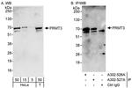 PRMT3 Antibody in Western Blot (WB)