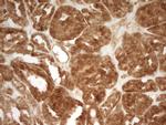 PRMT5 Antibody in Immunohistochemistry (Paraffin) (IHC (P))