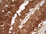 PRMT5 Antibody in Immunohistochemistry (Paraffin) (IHC (P))