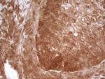 PRMT5 Antibody in Immunohistochemistry (Paraffin) (IHC (P))