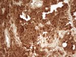 PRMT5 Antibody in Immunohistochemistry (Paraffin) (IHC (P))