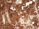 PRMT5 Antibody in Immunohistochemistry (Paraffin) (IHC (P))