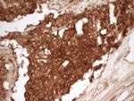 PRMT5 Antibody in Immunohistochemistry (Paraffin) (IHC (P))