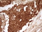 PRMT5 Antibody in Immunohistochemistry (Paraffin) (IHC (P))