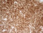 PRMT5 Antibody in Immunohistochemistry (Paraffin) (IHC (P))