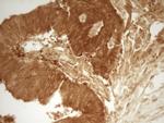 PRMT5 Antibody in Immunohistochemistry (Paraffin) (IHC (P))