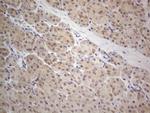 PRMT5 Antibody in Immunohistochemistry (Paraffin) (IHC (P))