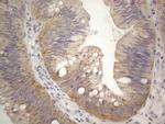 PRMT5 Antibody in Immunohistochemistry (Paraffin) (IHC (P))