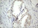 PRMT5 Antibody in Immunohistochemistry (Paraffin) (IHC (P))