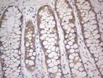 PRMT5 Antibody in Immunohistochemistry (Paraffin) (IHC (P))