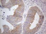 PRMT5 Antibody in Immunohistochemistry (Paraffin) (IHC (P))