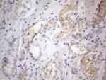 PRMT5 Antibody in Immunohistochemistry (Paraffin) (IHC (P))