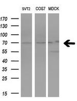 PRMT5 Antibody in Western Blot (WB)