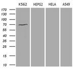 PRMT5 Antibody in Western Blot (WB)