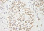 PRMT6 Antibody in Immunohistochemistry (IHC)