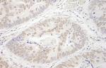 PRMT6 Antibody in Immunohistochemistry (IHC)