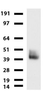 PROCR Antibody in Western Blot (WB)