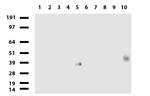 PROCR Antibody in Western Blot (WB)