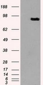 PROM2 Antibody in Western Blot (WB)