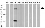 PROM2 Antibody in Western Blot (WB)