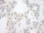 PRP6 Antibody in Immunohistochemistry (IHC)