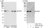 PRP6 Antibody in Western Blot (WB)