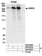 PRPF8 Antibody in Western Blot (WB)