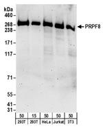 PRPF8 Antibody in Western Blot (WB)