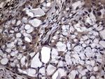 PRRX1 Antibody in Immunohistochemistry (Paraffin) (IHC (P))