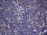 PRRX1 Antibody in Immunohistochemistry (Paraffin) (IHC (P))