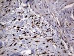 PRRX1 Antibody in Immunohistochemistry (Paraffin) (IHC (P))