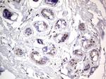 PRRX1 Antibody in Immunohistochemistry (Paraffin) (IHC (P))