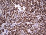 PRRX1 Antibody in Immunohistochemistry (Paraffin) (IHC (P))