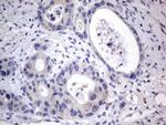 PRRX1 Antibody in Immunohistochemistry (Paraffin) (IHC (P))