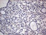 PRRX1 Antibody in Immunohistochemistry (Paraffin) (IHC (P))