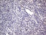 PRRX1 Antibody in Immunohistochemistry (Paraffin) (IHC (P))