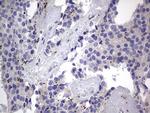 PRRX1 Antibody in Immunohistochemistry (Paraffin) (IHC (P))