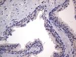 PRRX1 Antibody in Immunohistochemistry (Paraffin) (IHC (P))