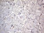 PRRX1 Antibody in Immunohistochemistry (Paraffin) (IHC (P))