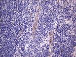 PRRX1 Antibody in Immunohistochemistry (Paraffin) (IHC (P))