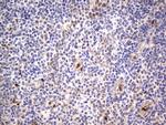 PRRX1 Antibody in Immunohistochemistry (Paraffin) (IHC (P))