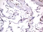 PRRX1 Antibody in Immunohistochemistry (Paraffin) (IHC (P))