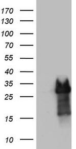 PRRX1 Antibody in Western Blot (WB)