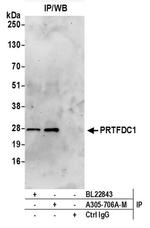 PRTFDC1 Antibody in Immunoprecipitation (IP)