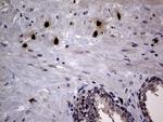 PRTN3 Antibody in Immunohistochemistry (Paraffin) (IHC (P))