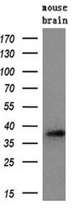 PRTN3 Antibody in Western Blot (WB)