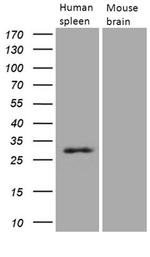 PRTN3 Antibody in Western Blot (WB)