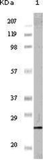 Progesterone Receptor Antibody in Western Blot (WB)