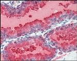 PSA Antibody in Immunohistochemistry (Paraffin) (IHC (P))