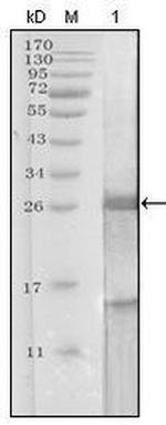 PSA Antibody in Western Blot (WB)